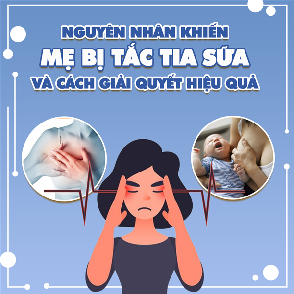 Nguyên nhân khiến mẹ bị tắc tia sữa và cách giải quyết hiệu quả