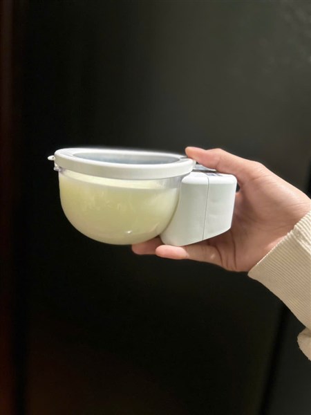  Lượng Sữa Hai Bên Lệch Nhau Có Bình Thường Không?